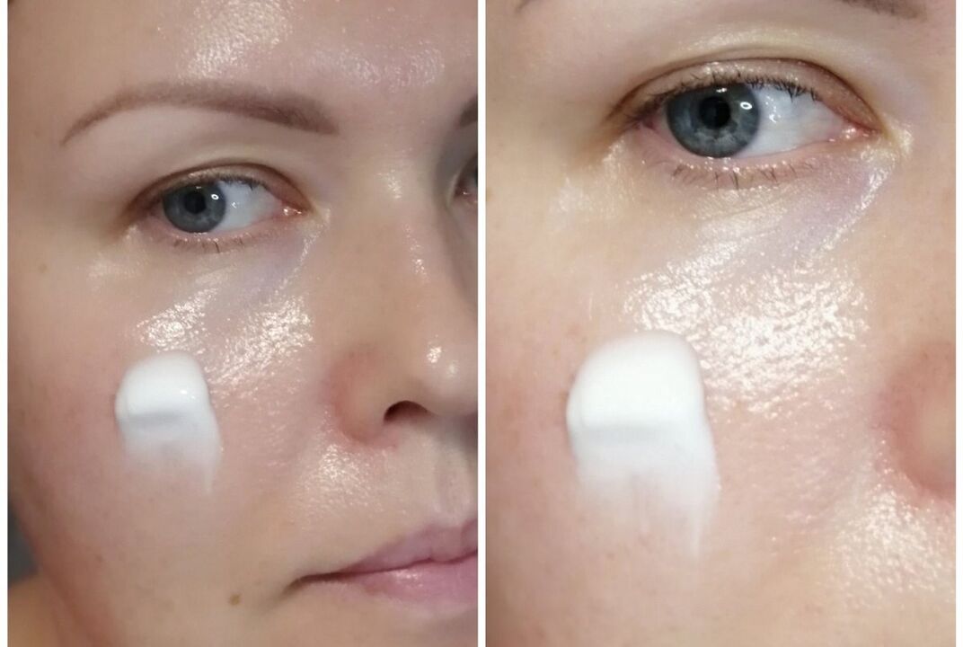 Application of the cream Inno Gialuron