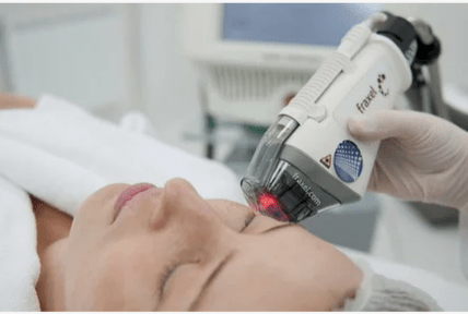 Laser rejuvenation