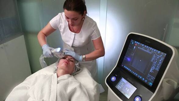 SMAS - ultrasonic lifting