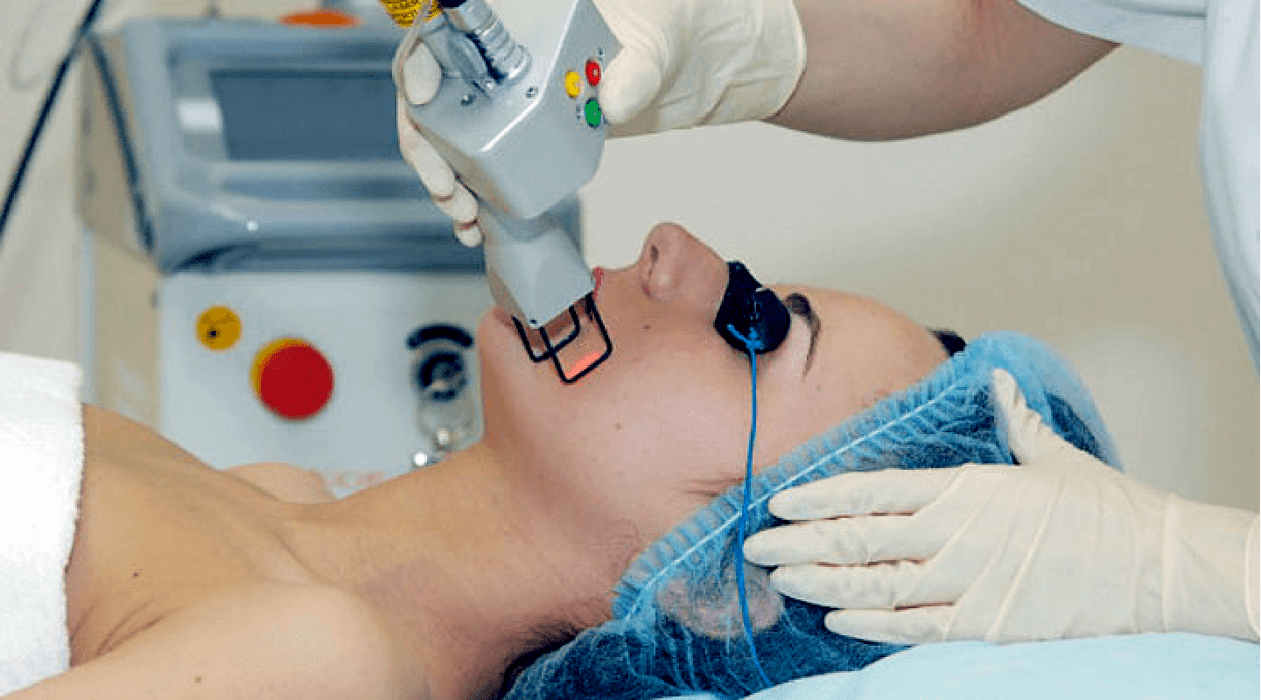 laser skin rejuvenation procedure